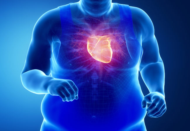 Tác hại của béo phì đối với sức khoẻ cơ thể