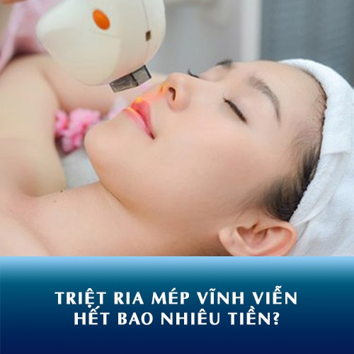 Triệt lông ria mép bao nhiêu tiền ?