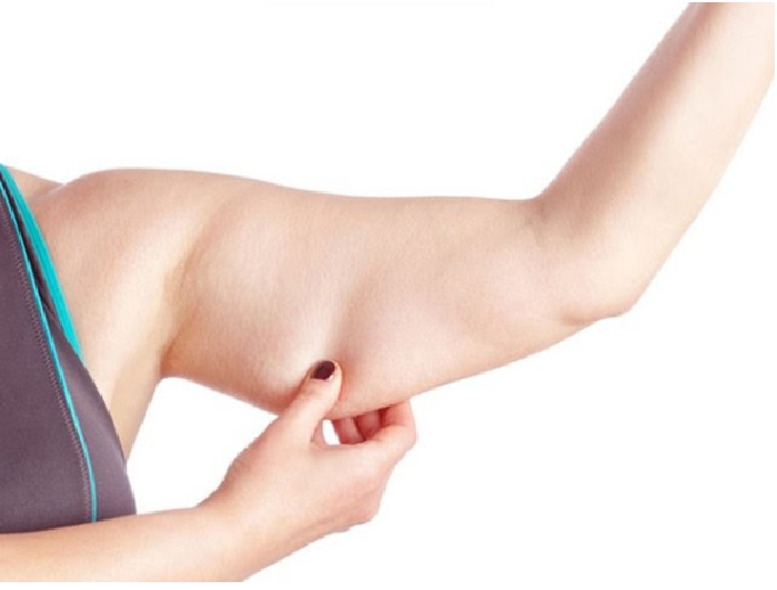 giảm béo bắp tay svietbeautyspa