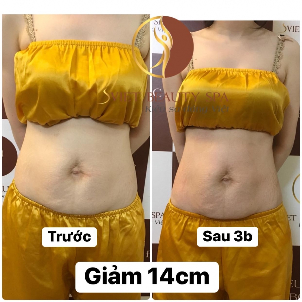 giảm béo tại sviet