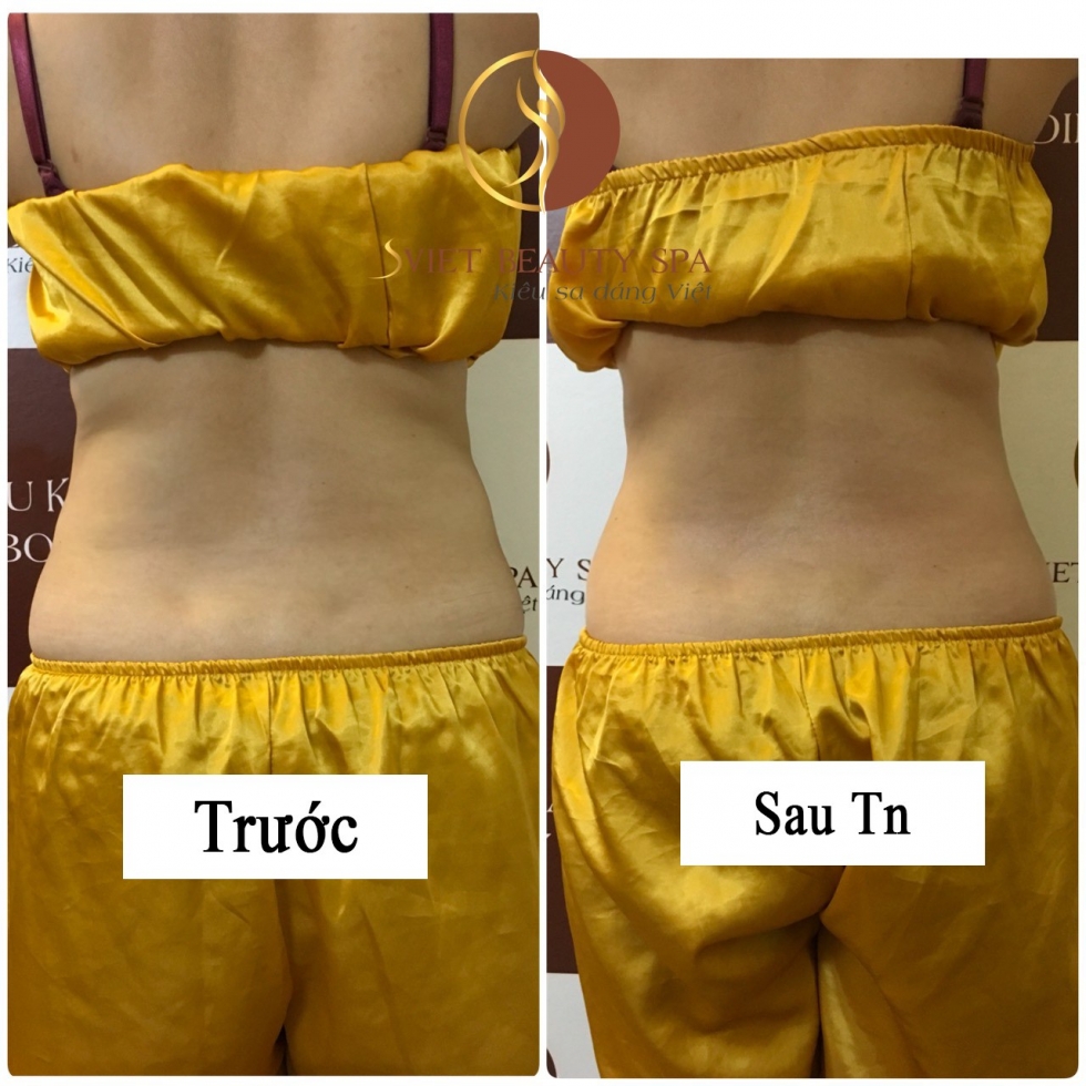 giảm béo hông tại sviet