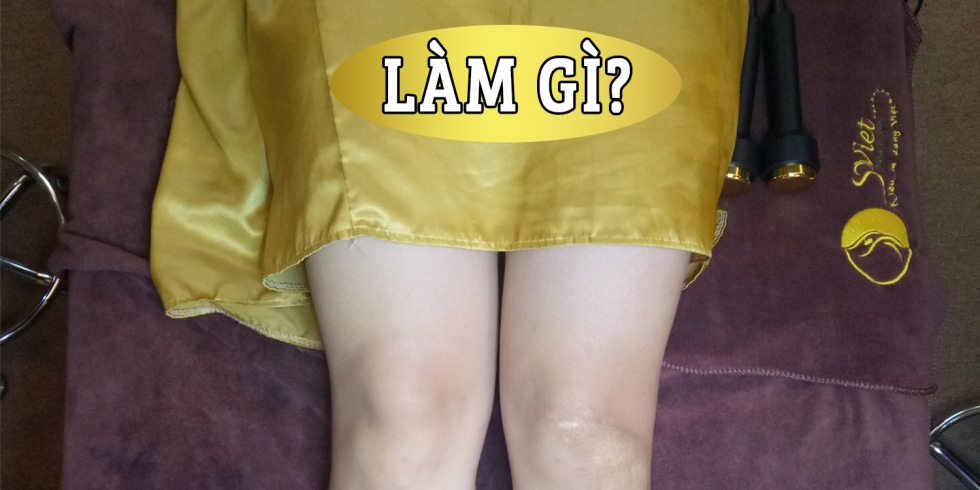 giảm béo không phẫu thuật tại Sviet Beauty Spa