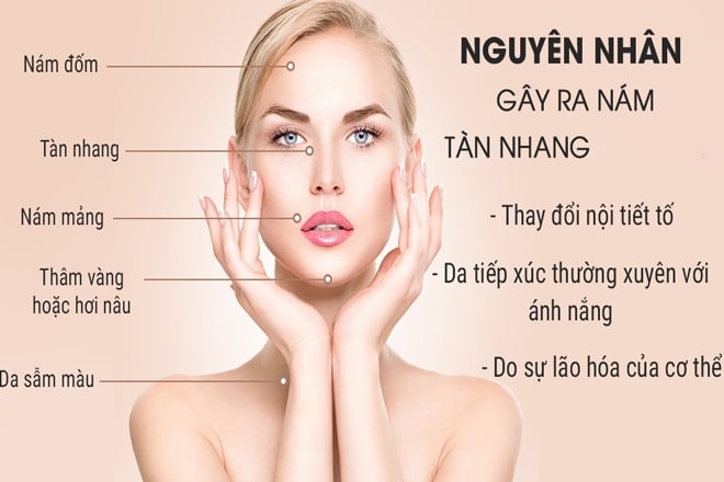 Nguyên nhân nám và tàn nhang