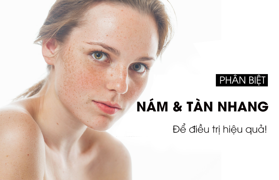 Phương pháp điều trị nám tàn nhang hiệu quả an toàn