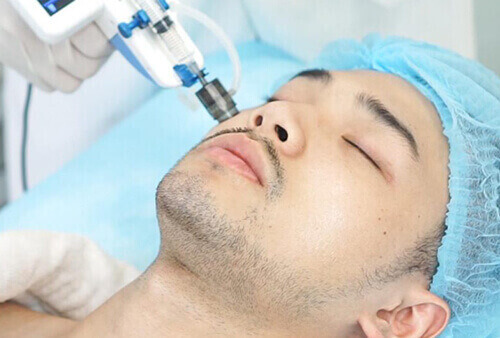 Triệt lông vĩnh viễn giúp nam giới chỉn chu gọn gàng