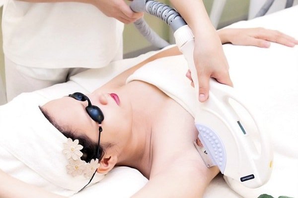 Triệt lông công nghệ mới nhất hiện nay tại Svietspa giải pháp triệt lông an toàn hiệu quả