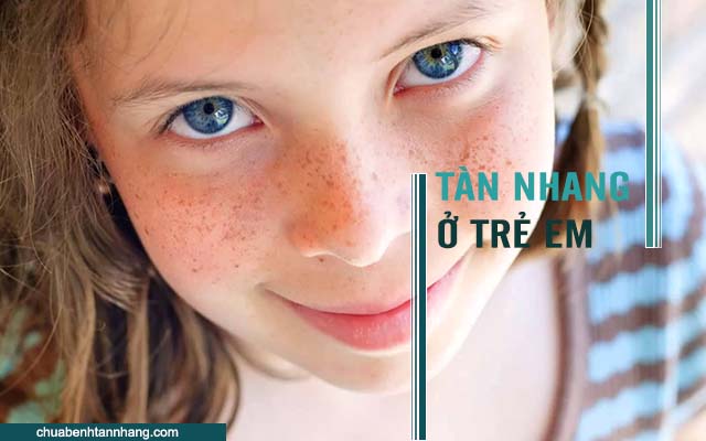 Tàn nhang ở trẻ em các nguyên nhận bạn cần biết để triều trị hiệu quả an toàn