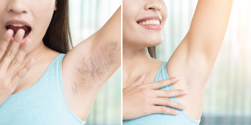 Lông nách hết khiến chị em vui mừng tự tin về bản thân