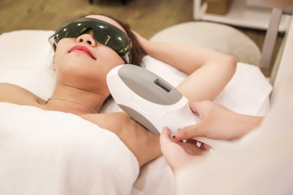 Triệt lông nách vĩnh viễn tại Sviet Spa