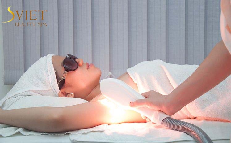 Cách chăm sóc da sau khi triệt lông nách vĩnh viễn tại Sviet Spa.