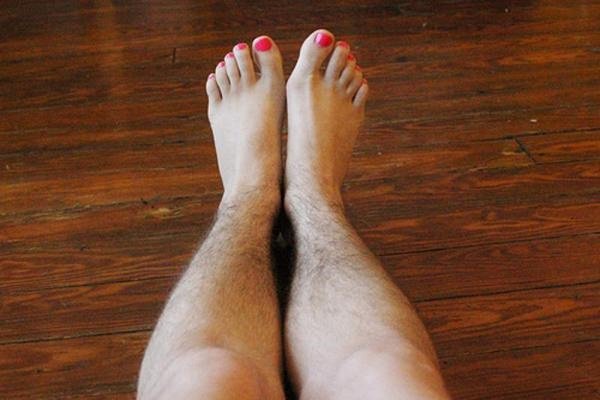 Nhiều lông chân khiến chị em tự ti