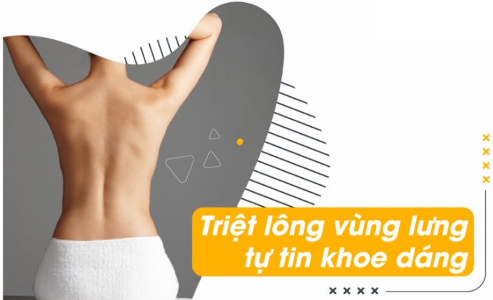Triệt lông lưng vĩnh viễn